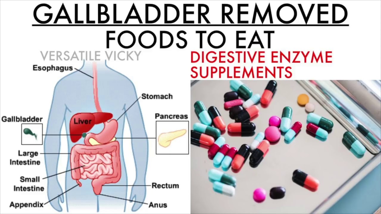 Gallbladder Removal Diet Chart