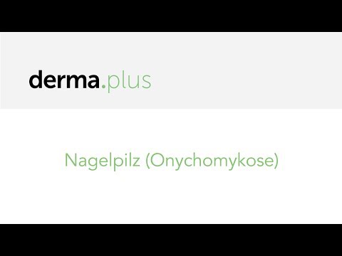 Video: Onychomykose - Arten, Ursachen Und Prävention Der Onychomykose