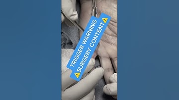 Finger Laceration: Tendon Demonstration