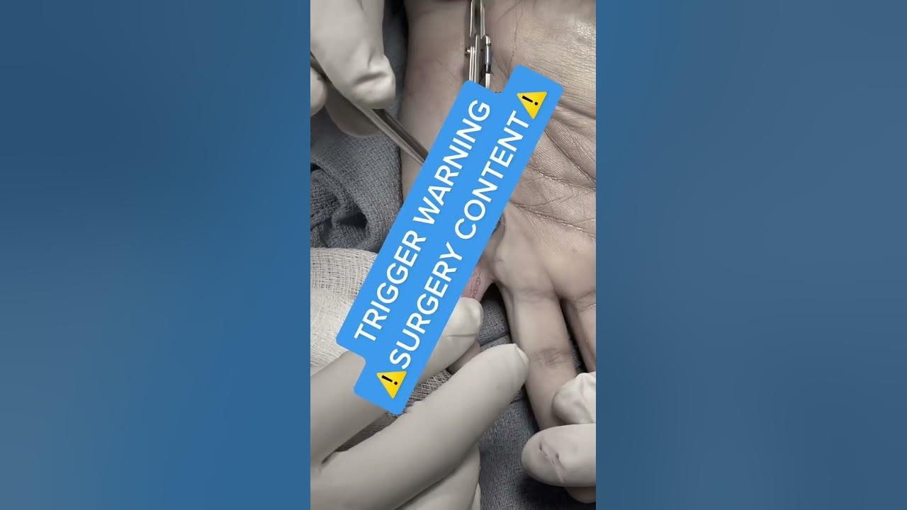 Finger Laceration Tendon Demonstration YouTube