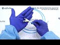 Sonda de alimentación yeyunal | sonda de alimentación enteral | sonda de alimentación gastrología
