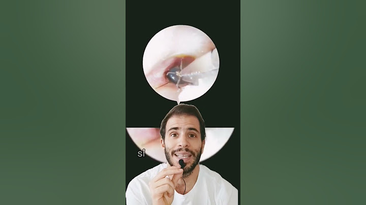 😱 A BUG got into my EAR 🐜🦗 What should I do? #shorts #medicine #insects