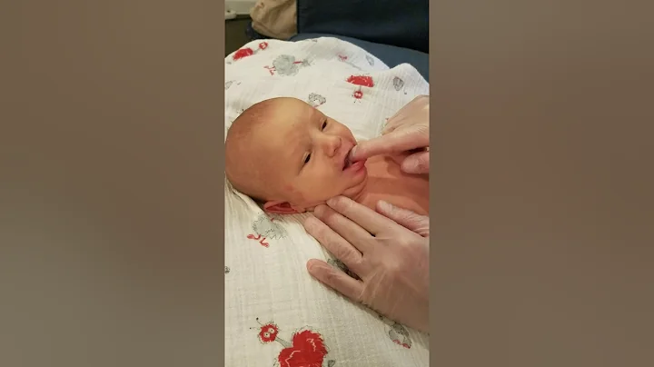 Newborn post-frenectomy care by Melissa Cole, MS, ...