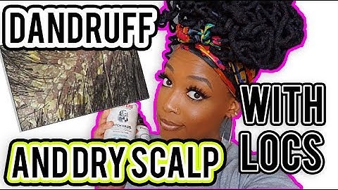 HOW TO GET RID OF DANDRUFF/DRY SCALP WITH LOCS