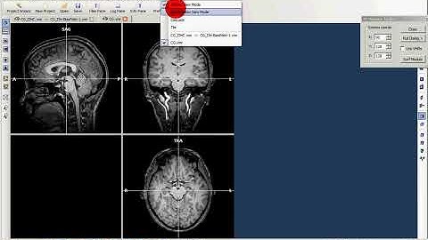 BrainVoyager QX - tutorial 2- inhomogeneity correction.avi