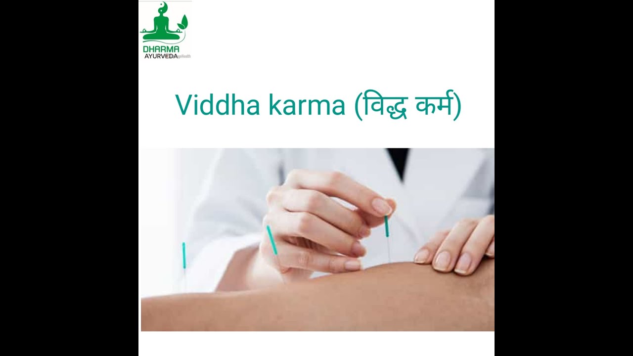 Viddha karma ,विध्द कर्म in marma point YouTube