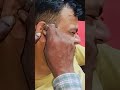 Highly Satisfying Earwax Removal ✨#shortvideo #shortsfeed #shortsviral #shorts #short #viral #video