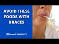 What Can I Eat the First Day Wearing Braces?