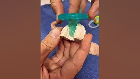 #dentist #dental #dentaltok #parenting  #pacifier #pacifierproblems #pacifierwea