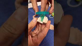 #dentist #dental #dentaltok #parenting #pacifier #pacifierproblems #pacifierwea