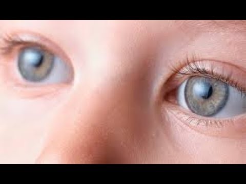 Vídeo: Ojos Brillantes: 13 Consejos Simples Para Ojos Brillantes Y Saludables