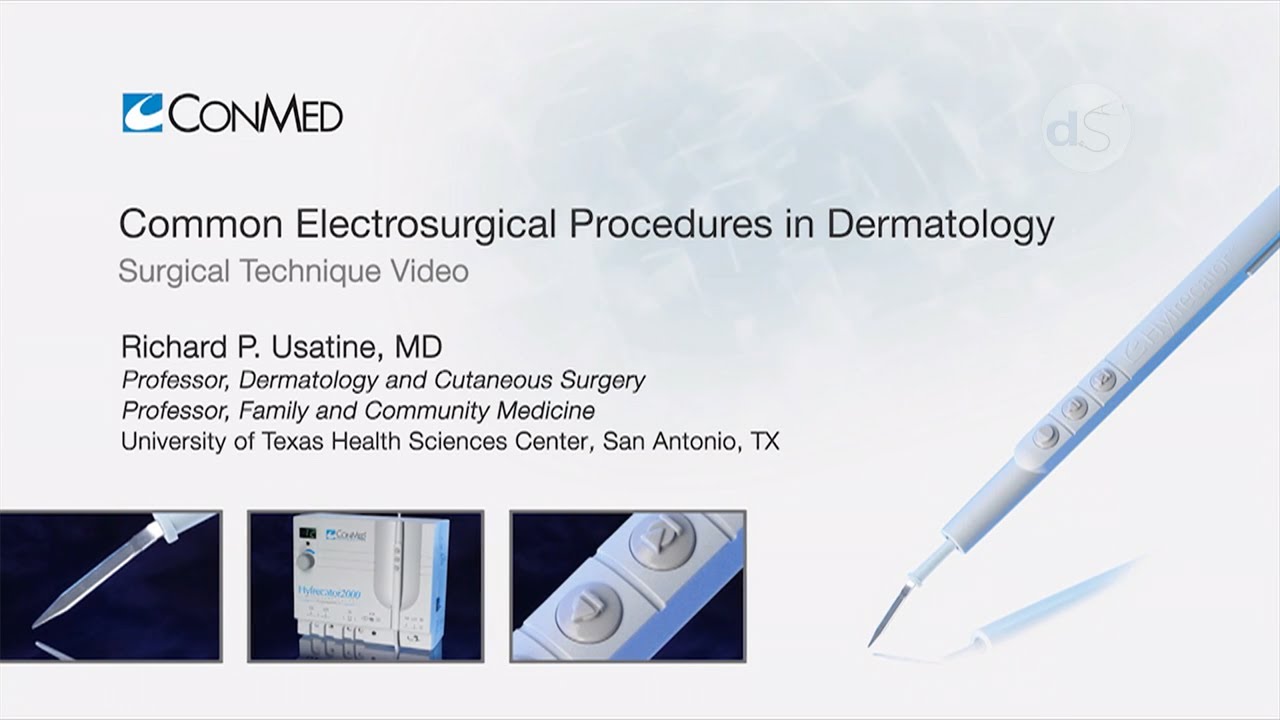 Common Electrosurgical Procedures in Dermatology using Conmed Hyfrecator® 2000 Dr Richard