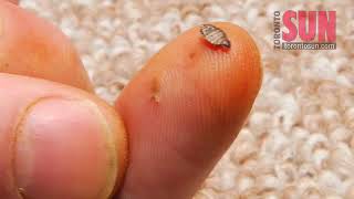 Banning pesticide caused bed bug boom