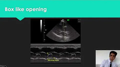 m mode-Interpretation and Utility-Echocardiography Basics