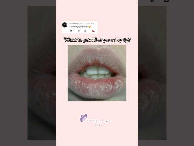 want to get rid for your dry lip?🍒 #pretty_butterfly_x #subscribe #edit #newaesthetic #glowup class=