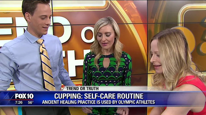 The healing practice of cupping