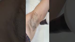 NEW at DermaEnvy ✨ Underarm Lightening is officially here 🧡