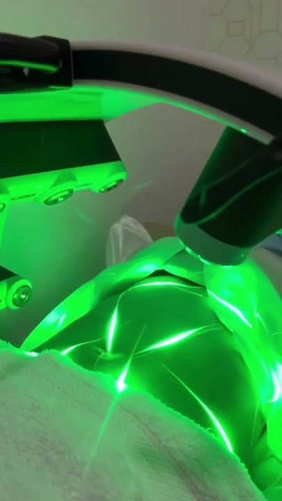 emerald-laser-by-erchonia-non-invasive-fat-loss-treatment-shorts
