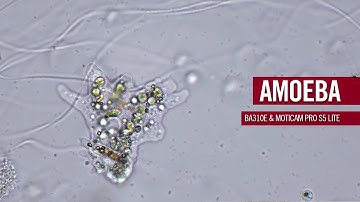 Amoebas - Shapeshifters of the microworld | by Motic Europe