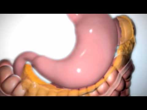 خطوات عملية التكميم