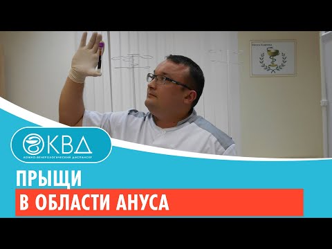 😟 Прыщи в области ануса. Клинический случай №503