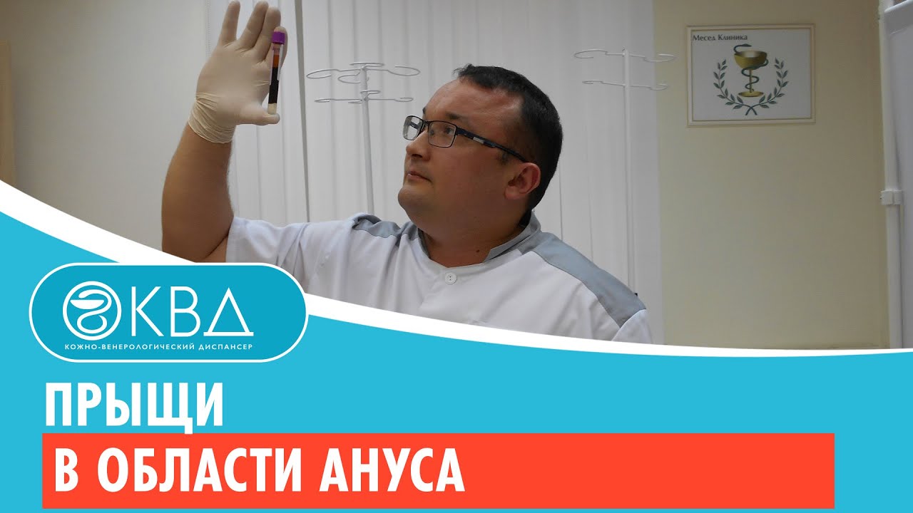 😟 Прыщи в области ануса. Клинический случай №503