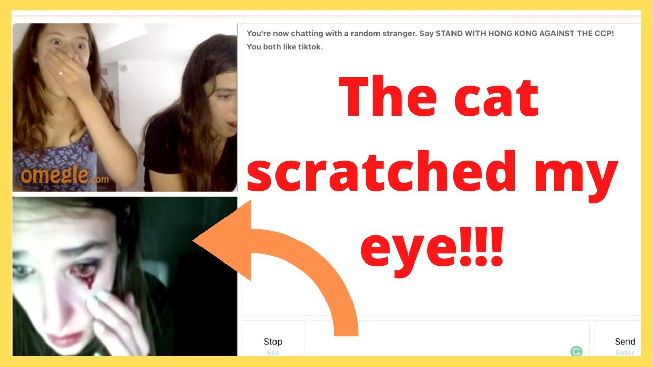Omegle Prank Cat Scratched My Eye Youtube 
