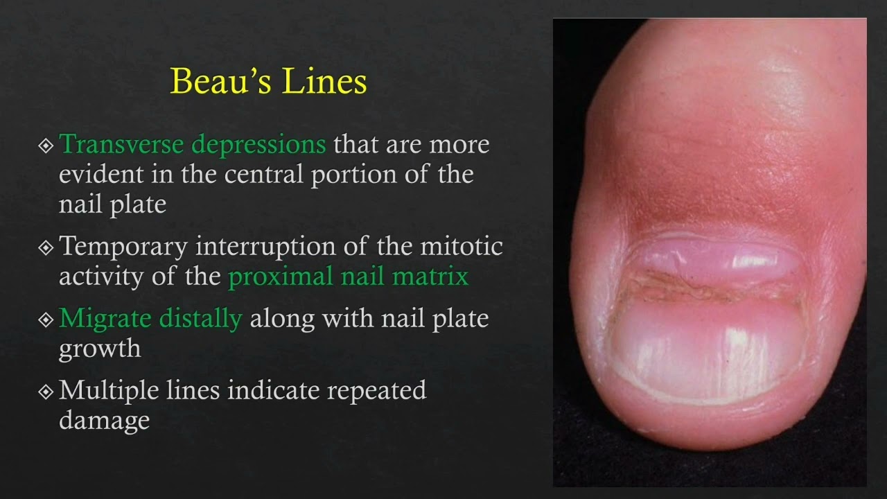 Do You Recognize These Nail Disorders? | Consultant360