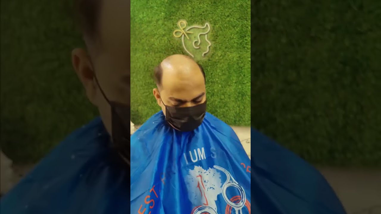 Australian Hair Patch Review: Is It REALLY Worth It? 