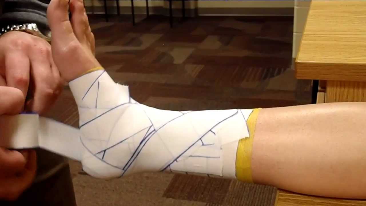 KIN 255 Ankle Taping - YouTube