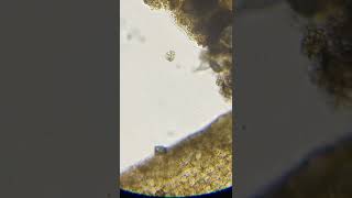 Microorganism under a microscope #smallyoutuber #science #shorts