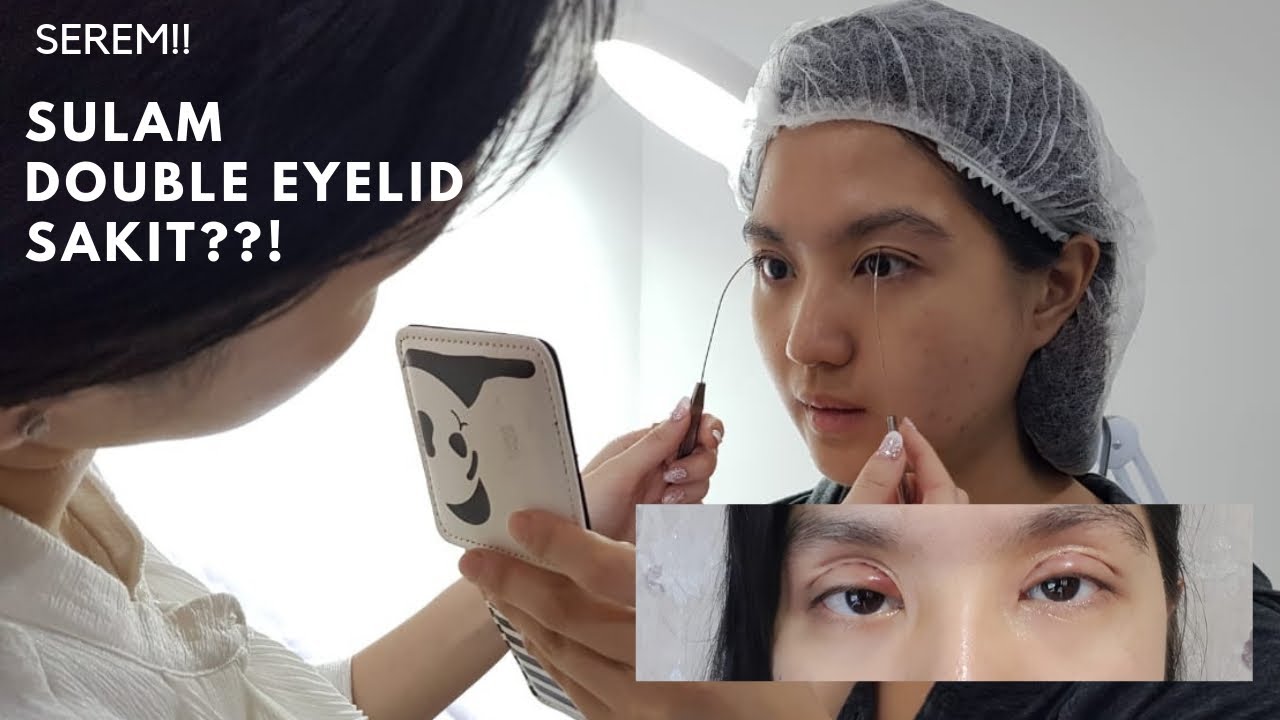 SEREM!! Sulam Eyelid (Lipetan Mata) Sakit??! - YouTube