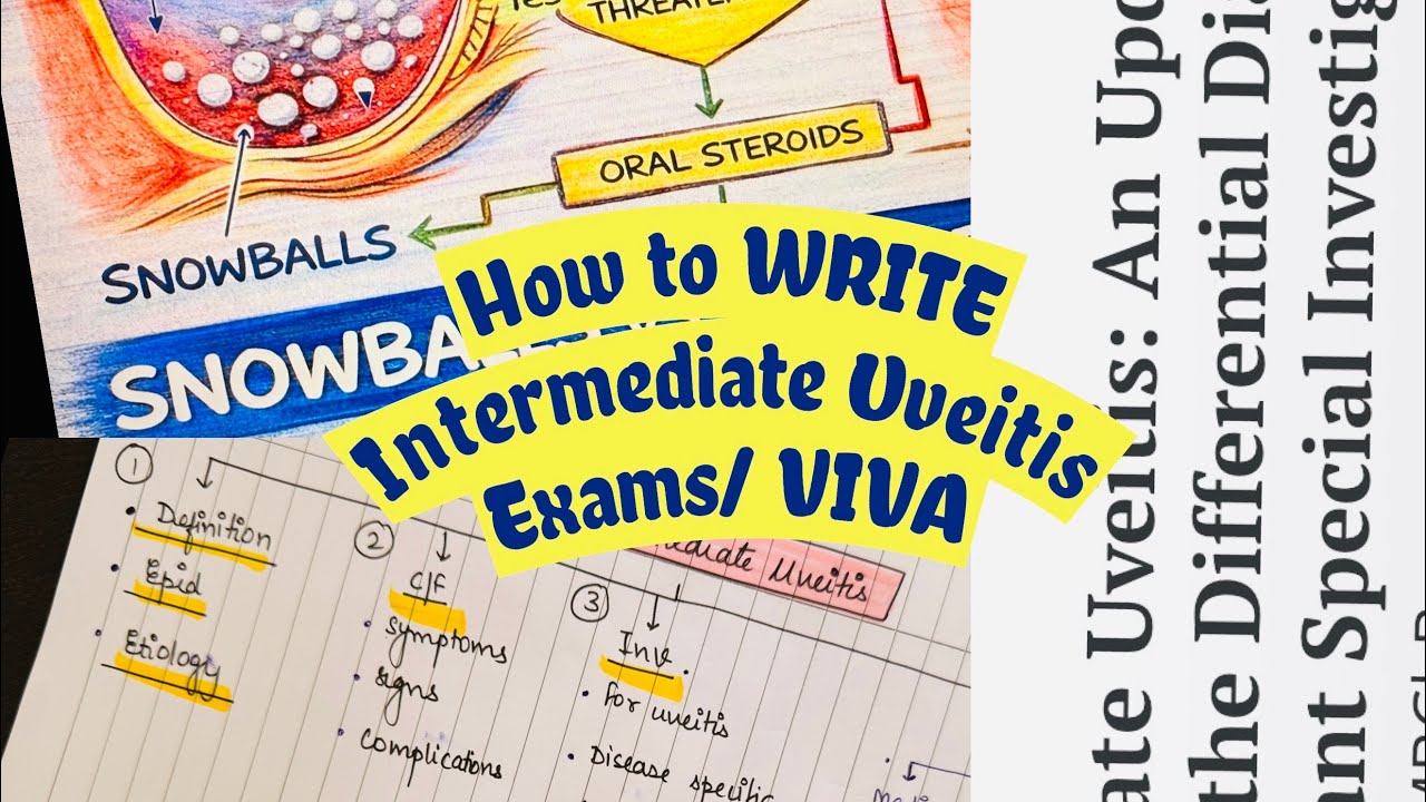 Intermediate Uveitis Made Easy | How to WRITE in Exams + Viva Pearls for Residents I MS/DNB Ophthal