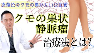 【下肢静脈瘤】クモの巣状静脈瘤の治療法とは？