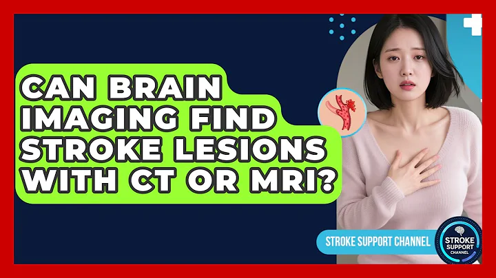 Can Brain Imaging Find Stroke Lesions With CT Or MRI? - Stroke Support Channel