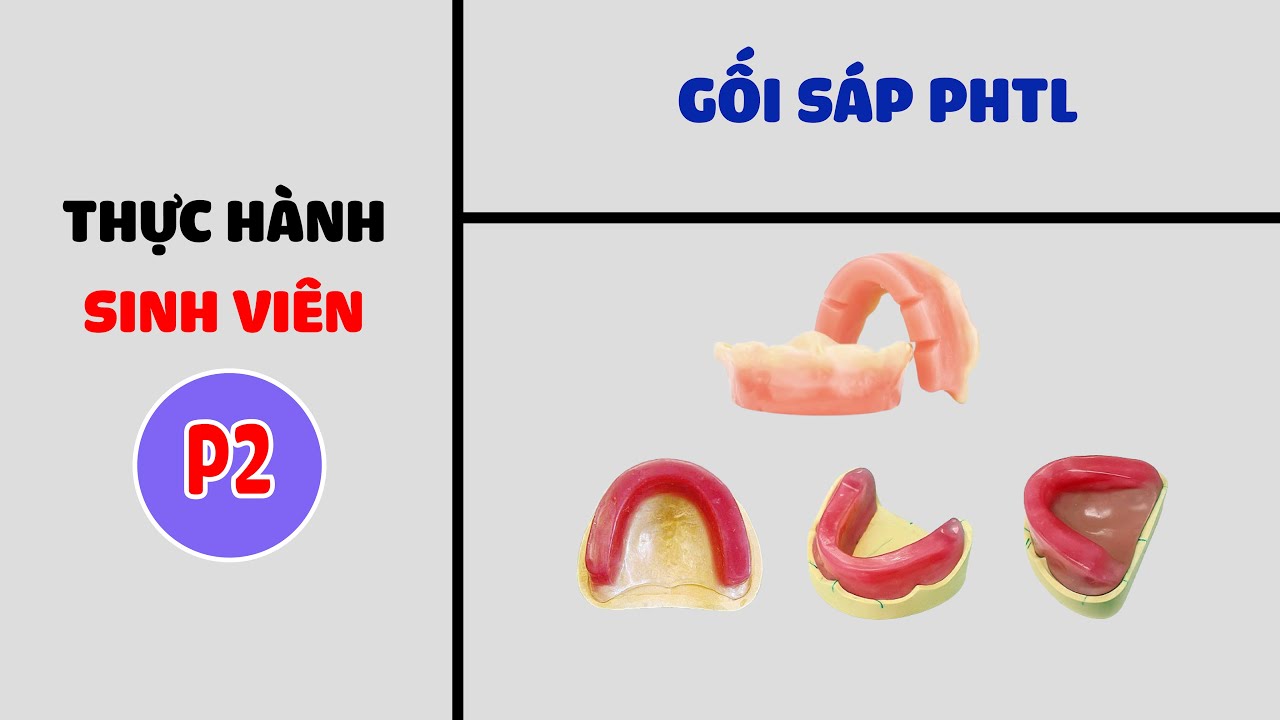Hướng dẫn làm gối sáp trong Phục hình tháo lắp bán hàm - Phần 2 - Thực hành sinh viên