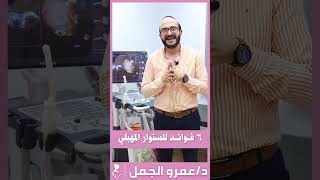 ٦ فوائد للسونار المهبلي