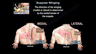 Scapular Winging  Everything You Need To Know  Dr. Nabil Ebraheim