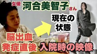 女優 河合美智子さん 2016年脳出血発症直後入院中の映像〜現在の回復に至るまで