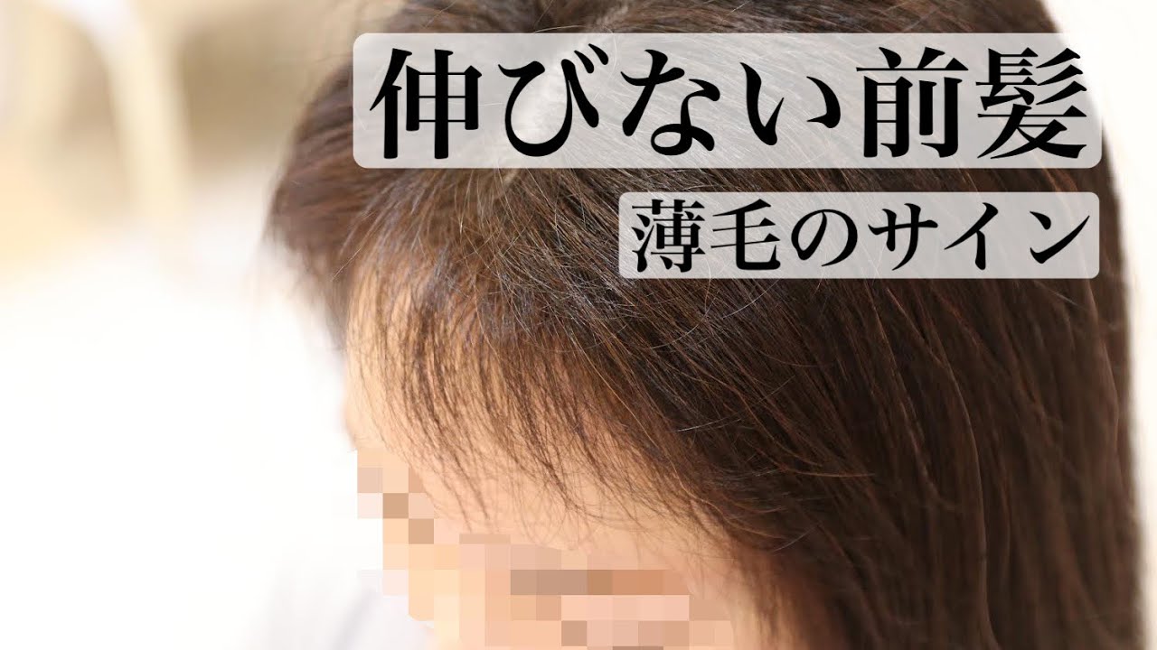 前髪 伸び ない