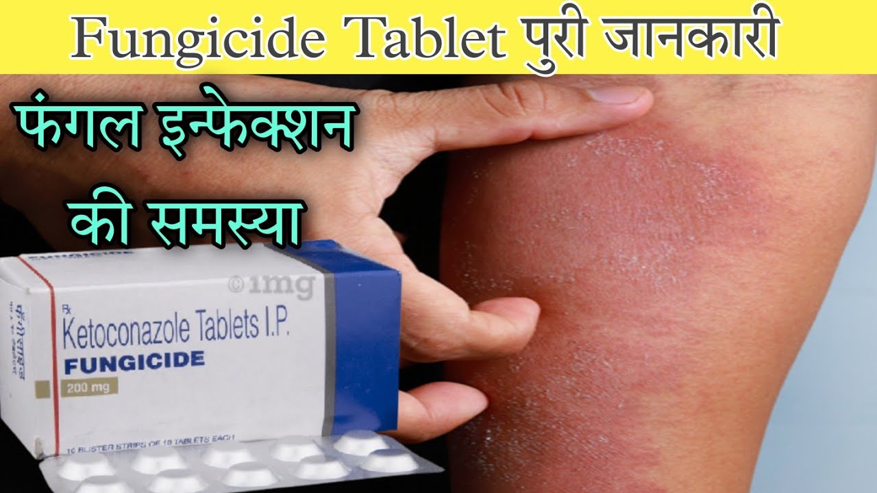 Fungicide Tablet Ketoconazole Tablet Uses Dose Sideeffects