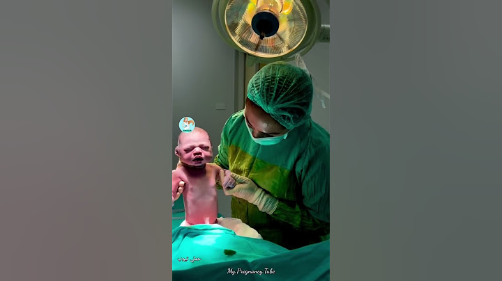 لحظة خروجه من بطن امه 💙الدكتورة طار عقله فيه 🤩🐣ماشاءالله