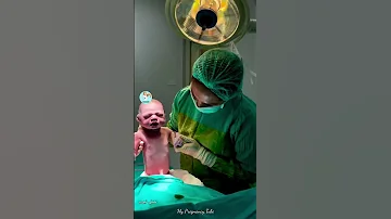 لحظة خروجه من بطن امه الدكتورة طار عقله فيه ماشاءالله 