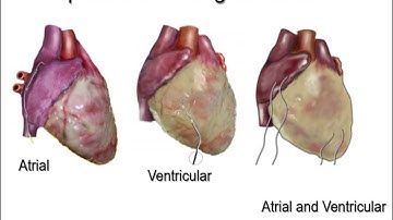 Dr. Manny Learn shop: Temporary cardiac pacing  Part 1