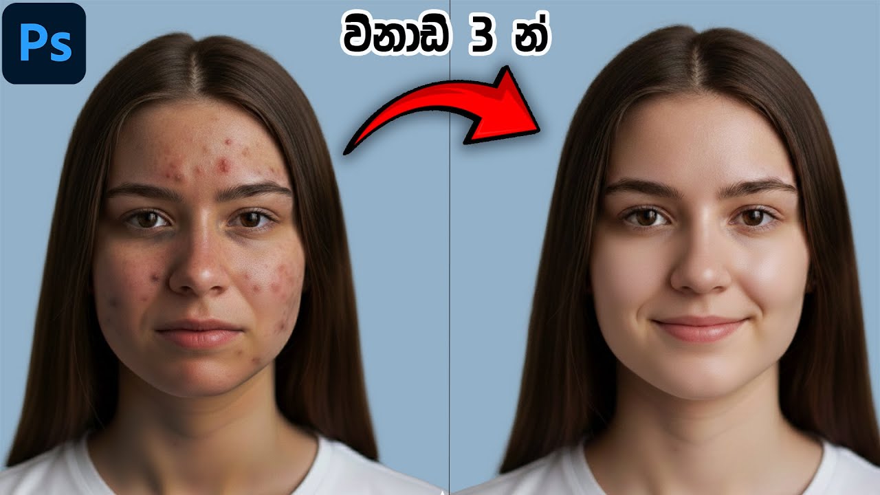 Photoshop Face Retouching Sinhala | Remove Pimples & Clear Skin Easily | Acne & Dark Sports Remove