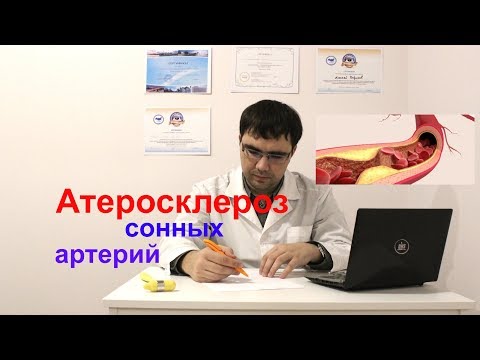 Атерокслероз сонных артерий: симптомы, лечение