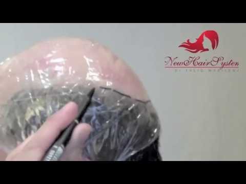 Come realizzare un calco per protesi di capelli