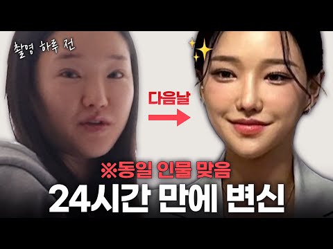 같은 사람 맞아요.. 저는 촬영 하루 전 날엔 이렇게 붓기와 살을 빼요✨