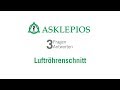 Luftröhrenschnitt: 3 Fragen 3 Antworten | Asklepios