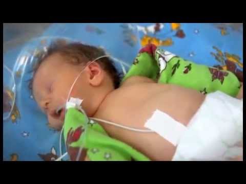 Офтальмологическая помощь новорождённым теперь доступна в Шымкенте